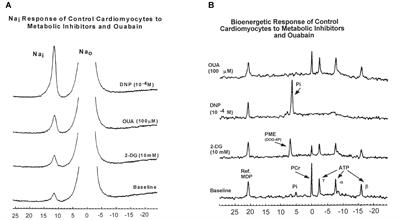 The Role of Sodium in Diabetic Cardiomyopathy